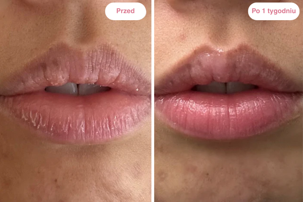 Peptydowy balsam do ust Clementa - Czereśnia