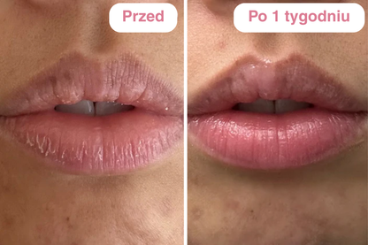 Peptydowy balsam do ust Clementa - Czereśnia