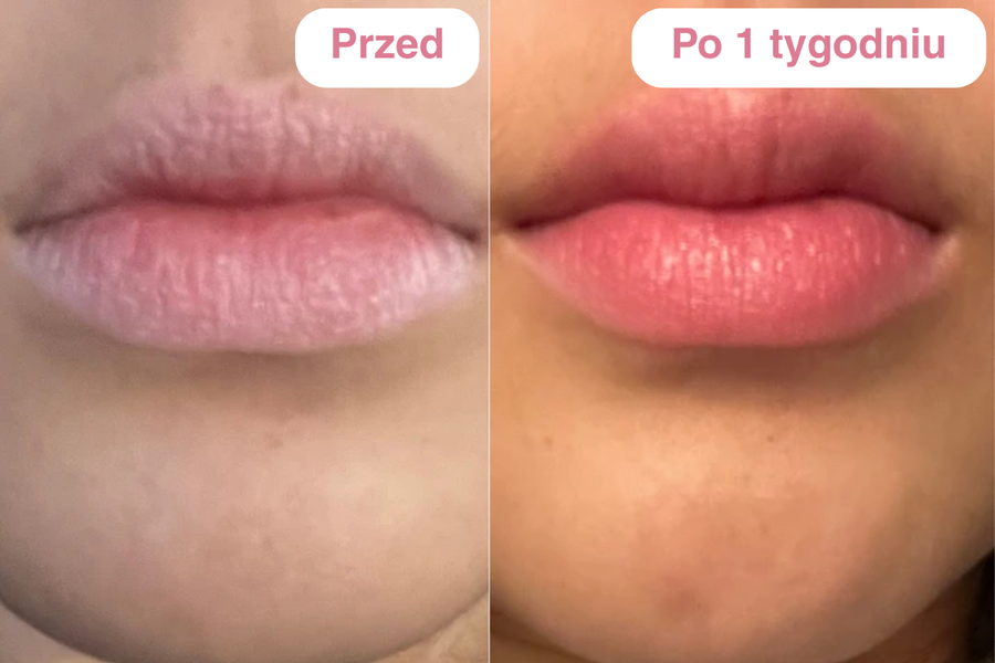 Peptydowy balsam do ust Clementa - Czereśnia