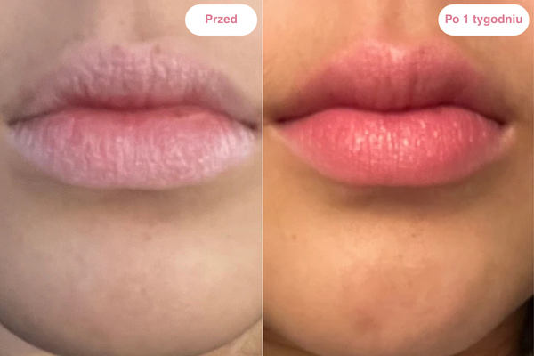 Peptydowy balsam do ust Clementa - Czereśnia