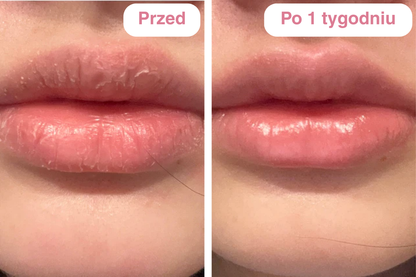 Peptydowy balsam do ust Clementa - Czereśnia