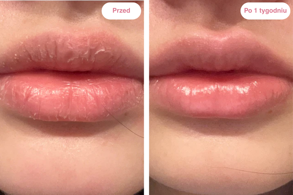 Peptydowy balsam do ust Clementa - Czereśnia