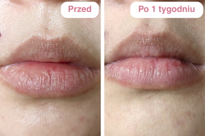 Peptydowy balsam do ust Clementa - Czereśnia