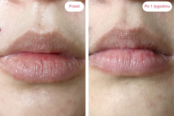 Peptydowy balsam do ust Clementa - Czereśnia