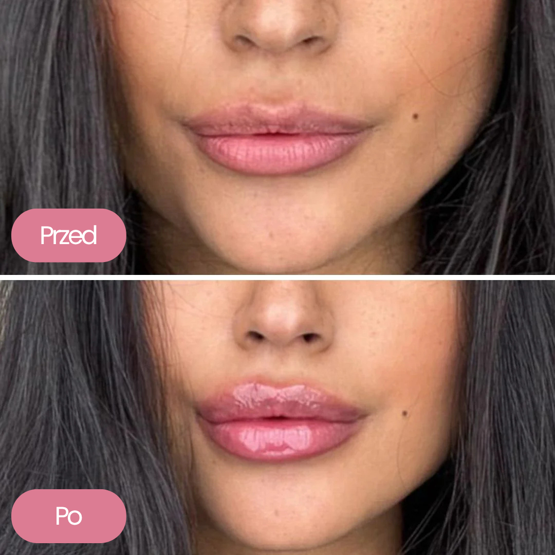 Powiększacz do ust Clementa