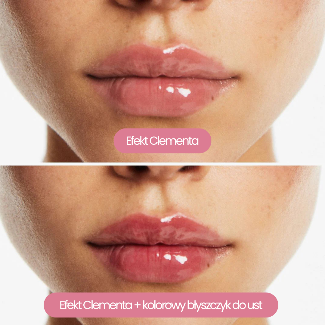 Powiększacz do ust Clementa